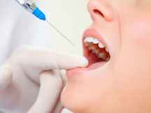 آموزش بی حسی دندانپزشکی