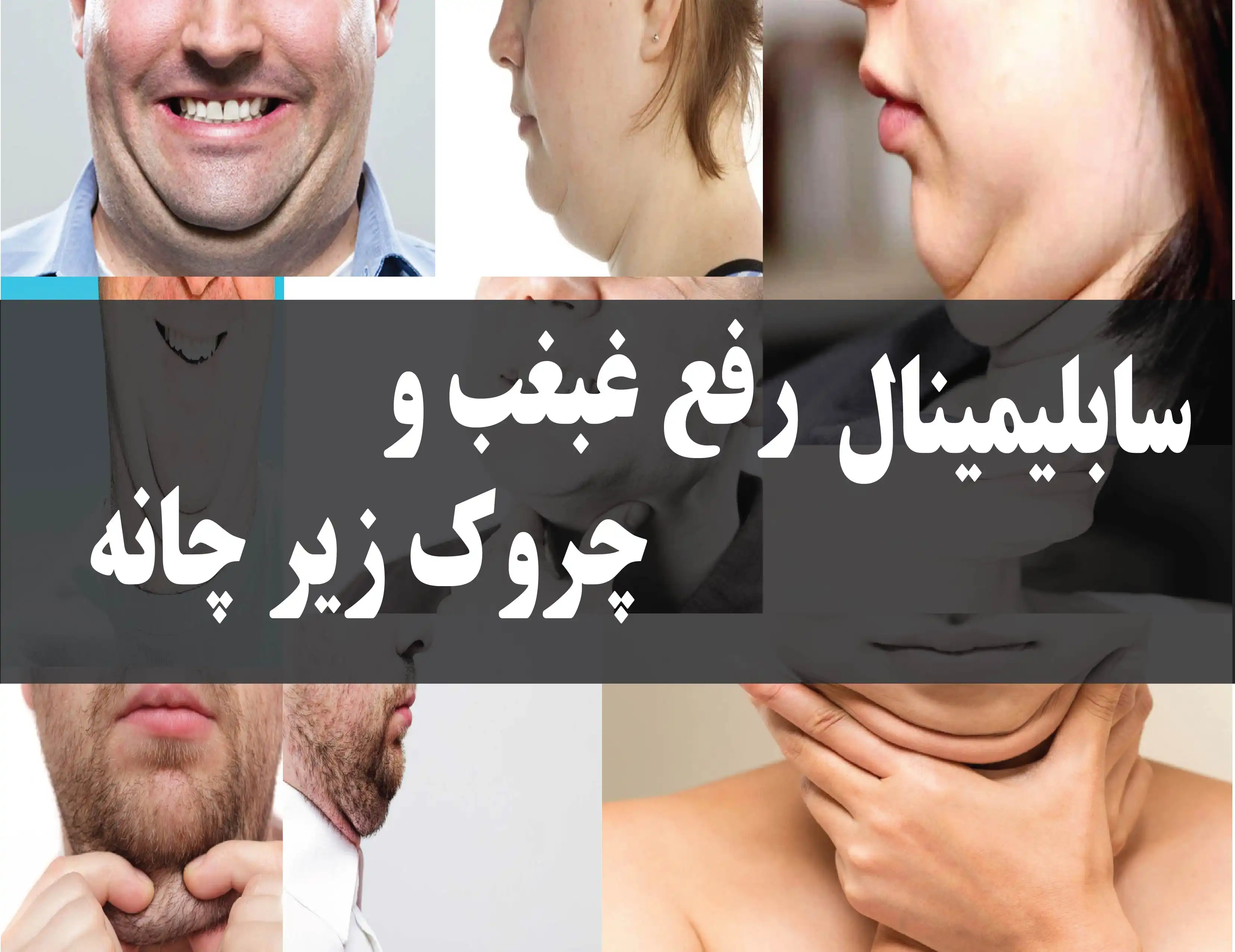 دانلود فایل سابلیمینال رفع غبغب و چروک زیر چانه | 