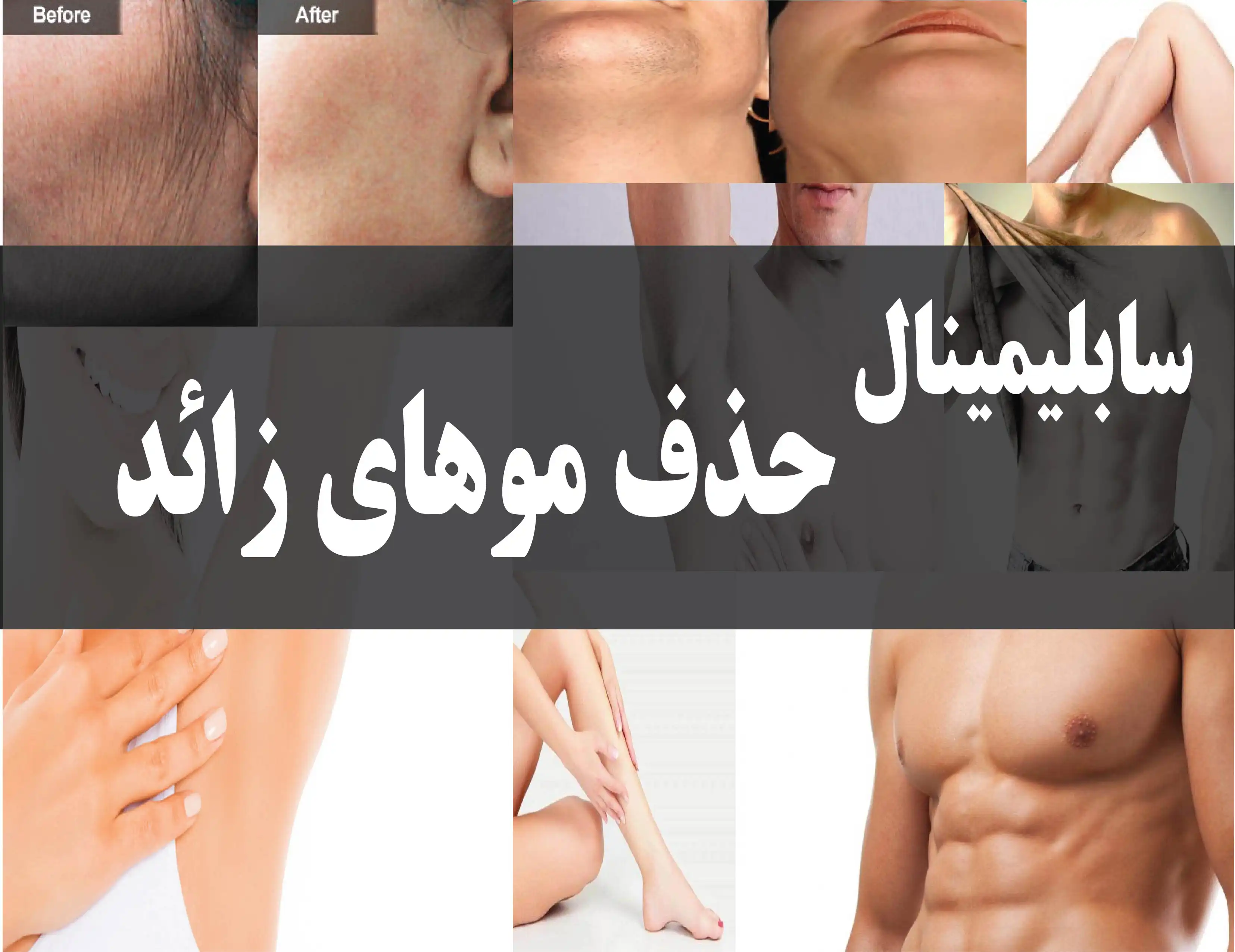 دانلود فایل سابلیمینال حذف موهای زائد | فاپول
