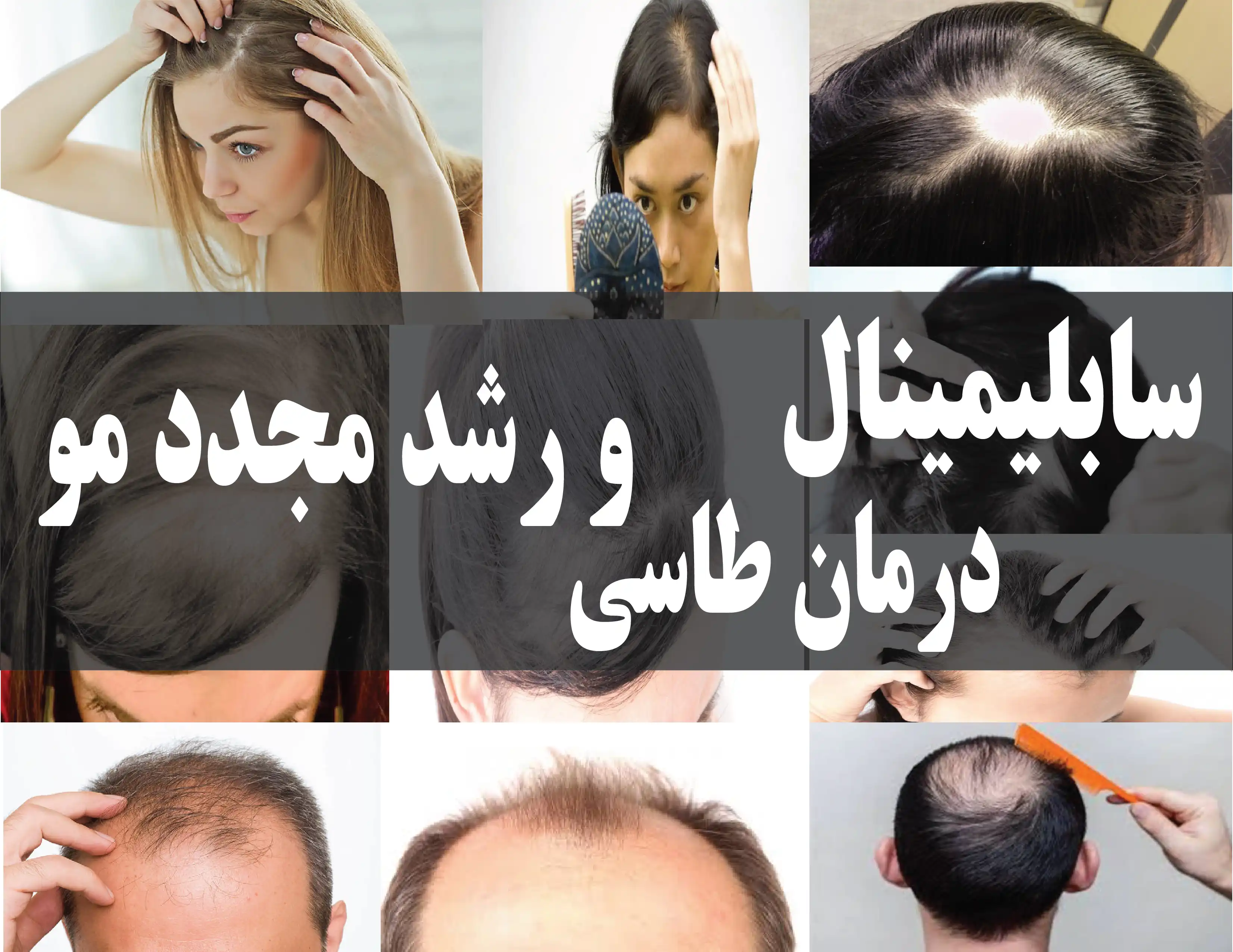دانلود فایل سابلیمینال درمان طاسی و رشد مجدد مو | 